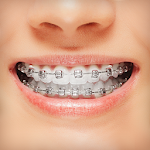 Braces screenshot-app